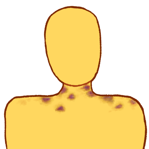 a digitally drawn image of a faceless bust with several hickeys on their neck and shoulders.